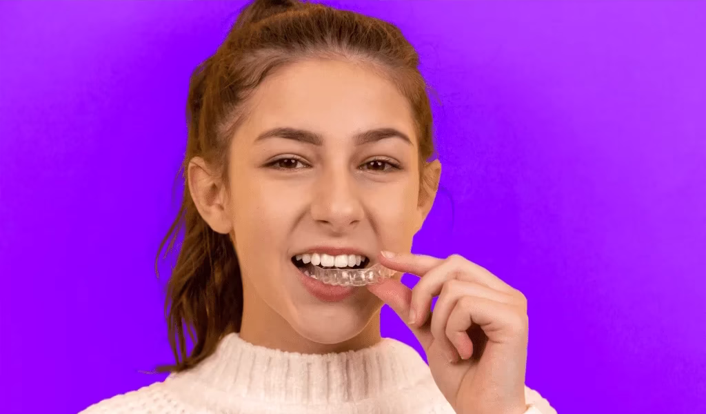 Aligners behandeling — Smile Again Tandarts